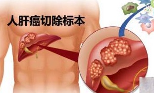 日本国立国际 医疗研究中心 中文服务